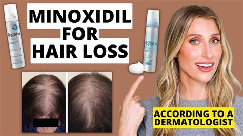 Minoxidil Works By Itself Limitations
