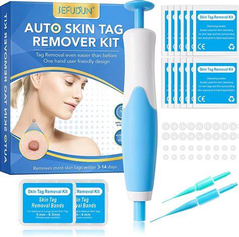 Say Goodbye to Skin Tags Permanently with Minty Delights Skin Tag Remover - the Ultimate Solution for Flawless and Radiant Skin!