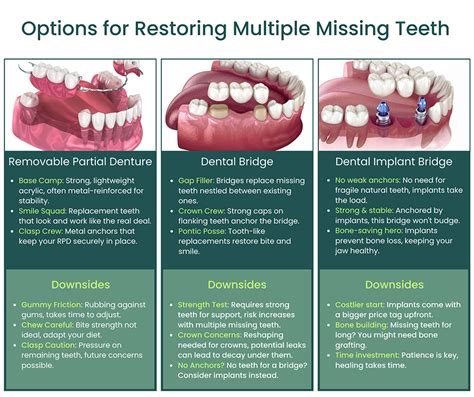 Missing Teeth: Solutions & Prevention Tips