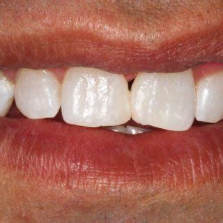 Download Mockup Com Resina Composta Object Mockups