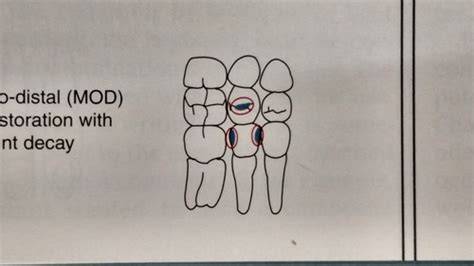 Mod Amalgam Charting