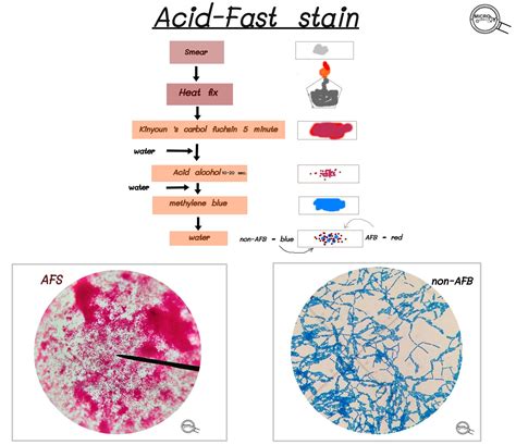 Modified Acid-Fast Stain Test and interpretation