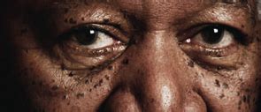 The Mysterious Skin Affliction of Iconic Actor Morgan Freeman: A Closer Look into his Struggle with Dermatosis Papulosa Nigra