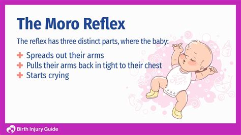 Moro Reflex