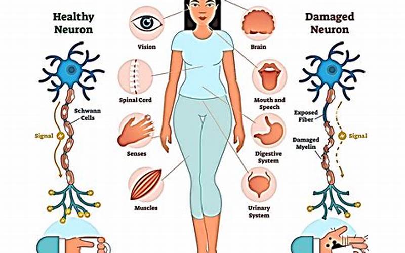 Multiple Sclerosis