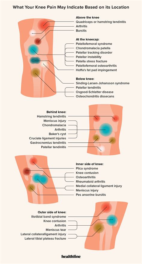 Muscle Pain Location Chart
