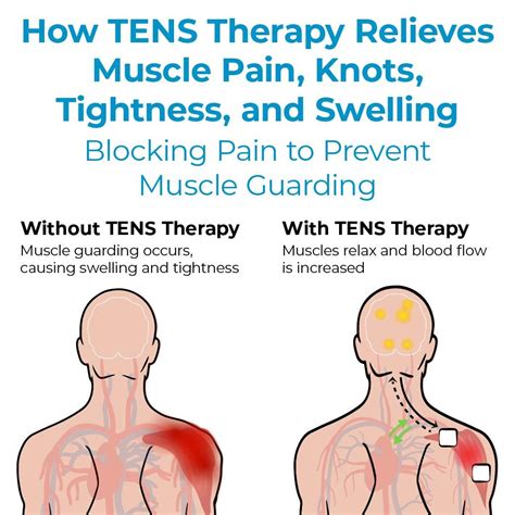 Muscle Therapy for Pain Relief