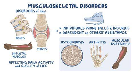 Musculoskeletal and Joint Issues