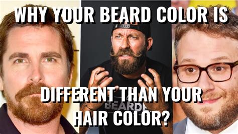 My Beard Is Different Colors