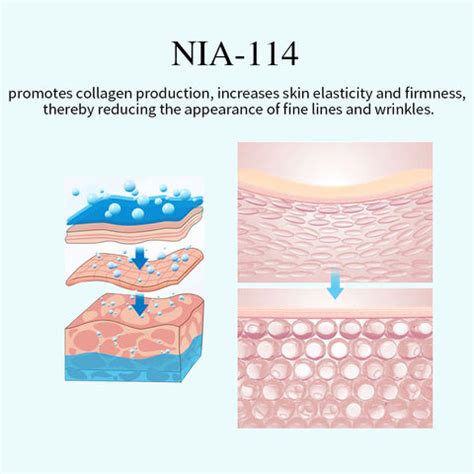 NIA-114 The Patented Core