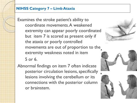 NIHSS Application in Stroke Assessment