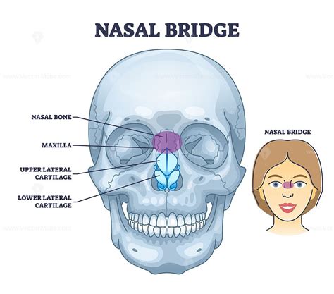 Nasal Bones Superoinferior (Axial) Radiographic