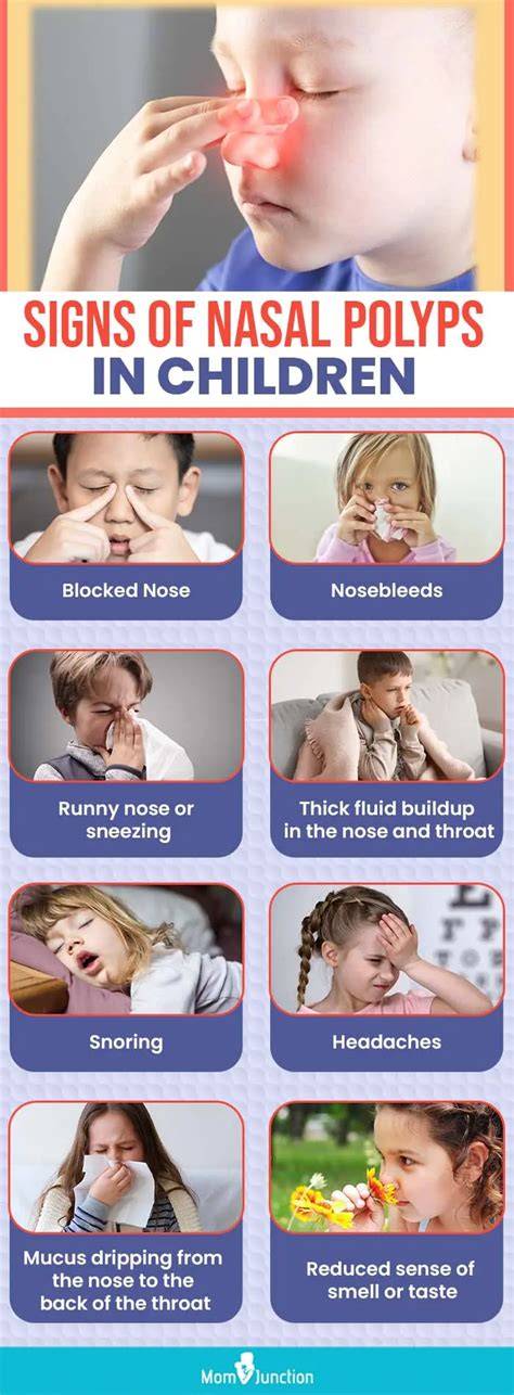 Nasal Polyps: Risks & Effective Treatment Options