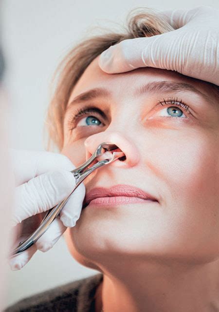 Nasal Polyps: Surgery & Medication Solutions