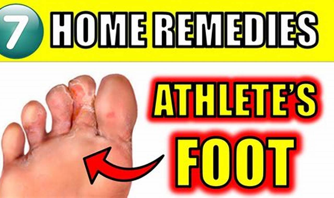 Natural remedies for fungal infections and athlete's foot