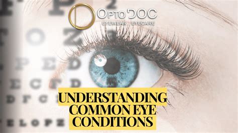 Navigating Common Eye Conditions
