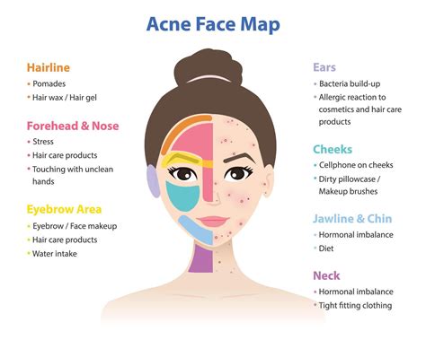 Neck Acne: Causes & Fast Treatment Solutions