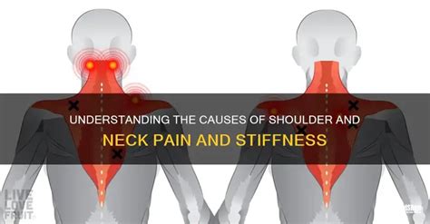 Neck and Shoulder Stiffness