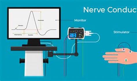 Nerve Conduction Study Cost With Insurance