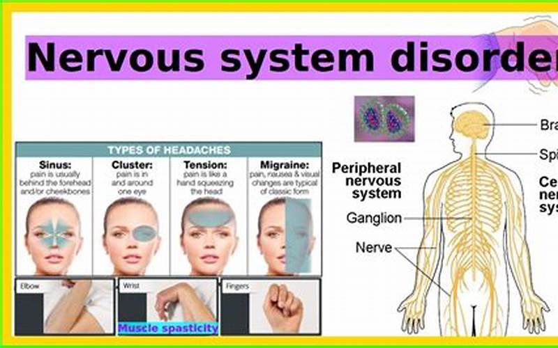 Nervous System Issues