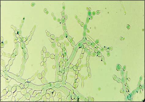 Neurospora Sitophila Adalah