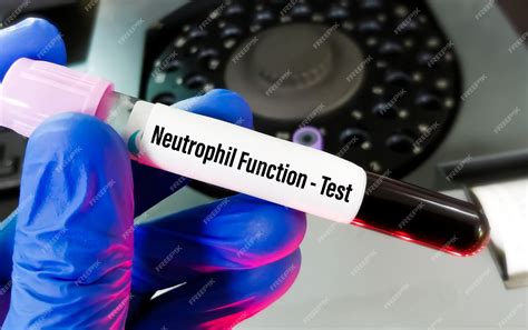 Neutrophil Function Test and interpretation