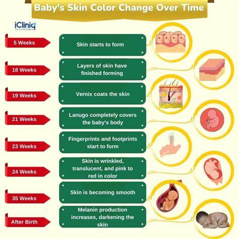 Newborn Baby Skin Color Chart