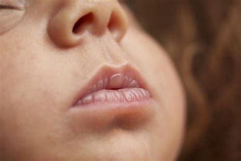 Newborn Chapped Lips: Causes & Soothing Relief