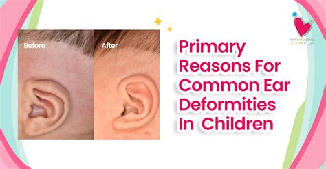 Newborn Ear Problems: Causes & Solutions