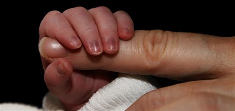 Discover the Fascinating World of Newborn Fingernails Attached to Skin: A Guide to Understanding This Unique Phenomenon
