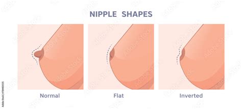 Nipple Type Chart