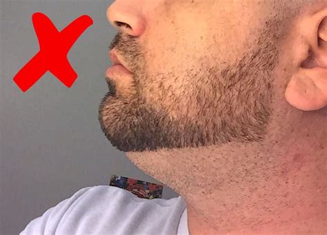 No Beard Under Chin