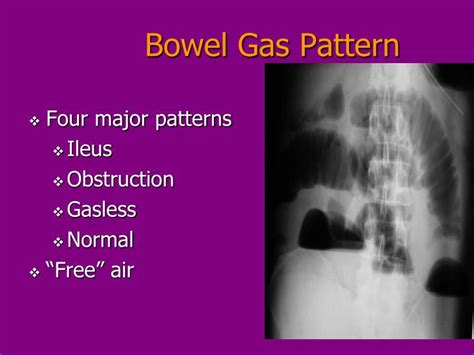 Non Obstructive Bowel Gas Pattern