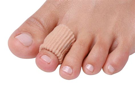 Non-Surgical Solutions for Fixing Claw Toes
