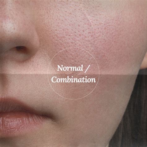 Normal and Combination Skin