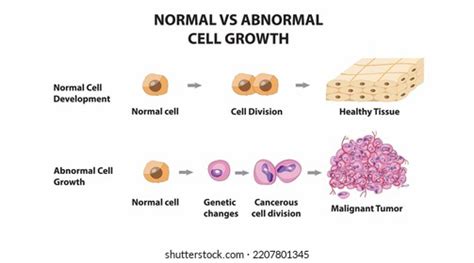 Normal vs. Abnormal: What the Numbers Mean