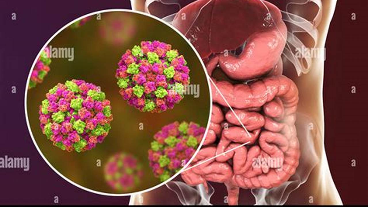 Norovirus Is A Disease Is Characterised By Nausea, Vomiting, Diarrhoea And Abdominal Pain (Picture, 2024