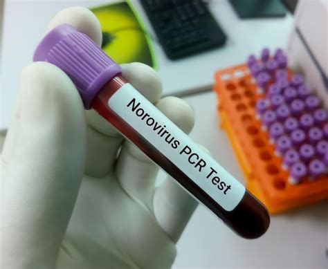 Norovirus PCR Test and interpretation