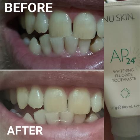 Get Brighter Smile with Nu Skin Toothpaste: A Comprehensive Review