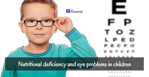 Nutritional Deficiencies and Vision