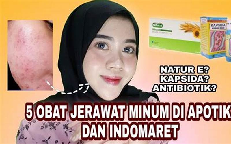 Obat Minum Untuk Jerawat Yang Tepat Dan Aman