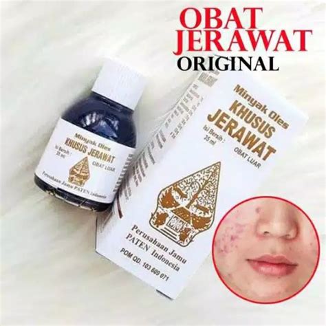Obat Jerawat Cap Wayang