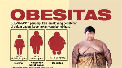 Obesitas