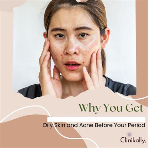 Say Goodbye to Oily Skin During Menstrual Cycle: Tips & Tricks!