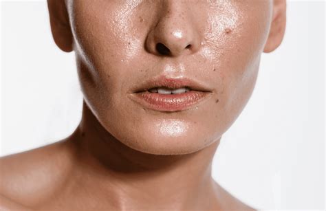 Oily