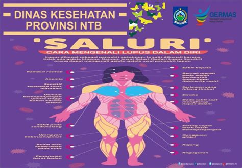 Gambar Olahraga sebagai penunjang kesehatan Glomerulonefritis Lupus Eritematosus Sistemik