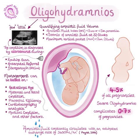 Oligohydramnios & Premature Birth: What You Need to Know.