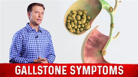 Olive Gold Will Eliminate the Stones in Your Gallbladder and Liver