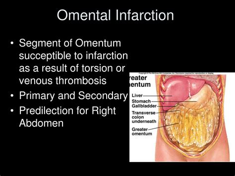 Omental Infarction Diet