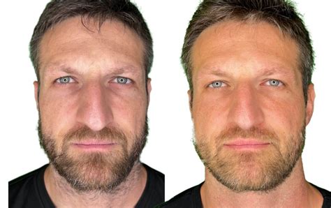 Transform Your Life with One Skin: Before and After Inspiration to Get Your Emotional Glow!